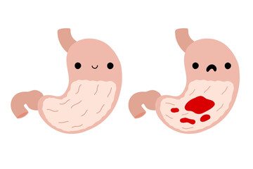 Stomach pain character. Healthy and ailing stomach. Cartoon internal organs. Gastritis and inflammation. Improper diet, acid, infection. Stock vector illustration isolated on white background.
