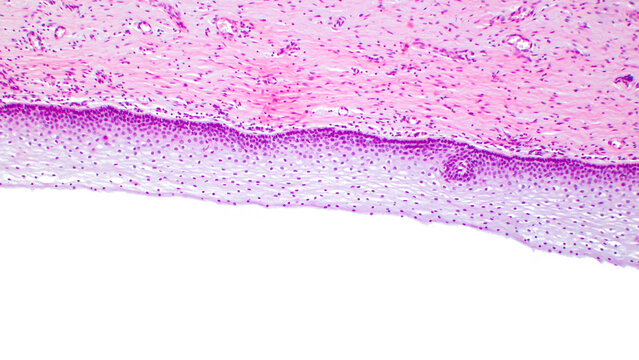 Vaginal epithelium (Non-keratinized stratified squamous epithelium of the vagina), light micrograph.