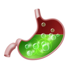 Naklejka premium Stomach suffering from acid reflux. Gastroesophageal reflux disease.
