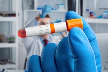 Hand researcher with blood tube. Analysis lab concept