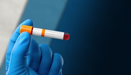 Doctor holding a test sample tube. The virus concept