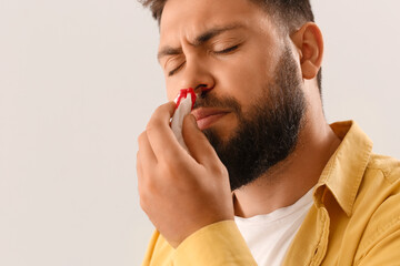 Young bearded man with nosebleed and tissue on light background, closeup