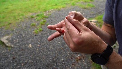 Man in nature cut his little finger and is squeezing his wound in front of camera while blood is pouring out over his hands - Close up of hands and wound with no face