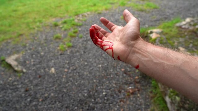 Man cut his finger and blood is pouring down his hand and arm - Sharp red color from fresh wound in finger - Hand held and turned in front of camera with no face and blurred background