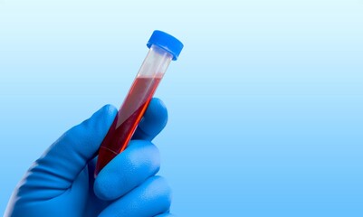 Doctor holding a test blood sample tube. Infected people