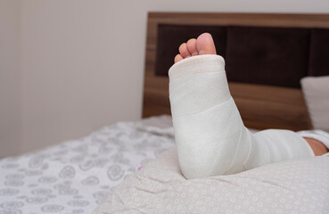 ankle and foot splint Bandages on the legs. Foot surgery, Wrapped feet with plaster or pressure bandage after operation