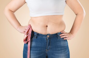 Obese woman against light background. Weight loss surgery concept