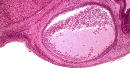 Mature (or Graafian) Follicles. This maybe an off-center cross section of a mature follicle because of its large size. Hematoxylin and eosin stain.