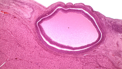 Light micrograph of human ovary showing Graafian follicle containing secondary oocyte. This maybe an off-center cross section of a mature follicle because of its large size.