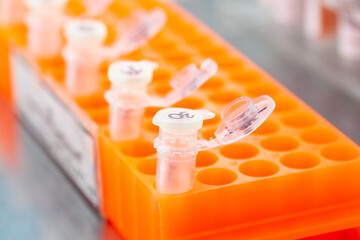 Rack of test tubes being used for DNA extraction using the spin column-based nucleic acid...