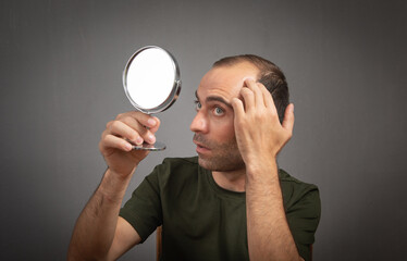 Man looking at mirror. Hair loss concept