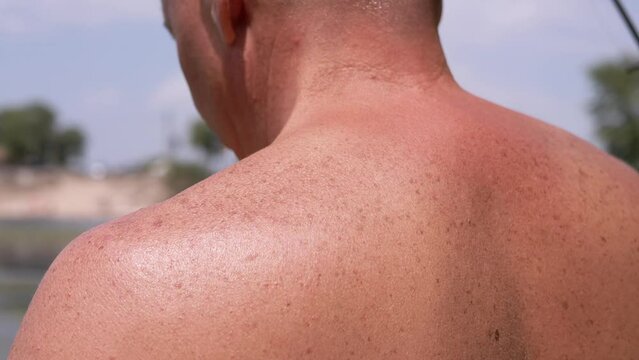 Tanned Shoulders, Back of a Bald Male Standing on the River Bank on Nature. Close-up. Back view. Resting, tanned guy with freckles, moles on back from the scorching sun. Fishing. Weekend. Summertime.