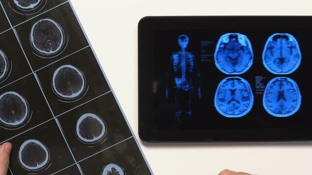 medical diagnosis on tablet