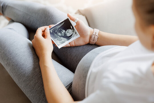 Pregnant woman with ultrasound image on sofa, top view. Concept expectant mother waiting for baby birth during pregnancy, light background
