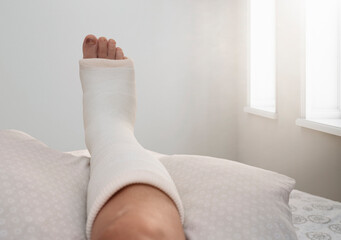 broken leg in the bedroom, close up