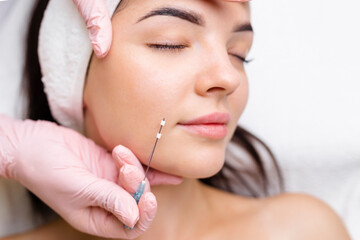 Face lifting PDO Suture operation. innovative technique of New thread lift, cosmetologist preparing...