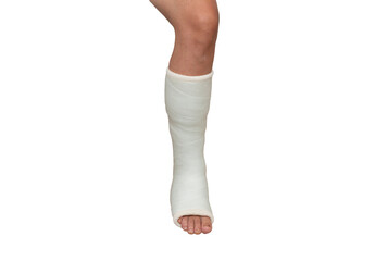 Woman with her broken leg. leg in a cast on isolated white background. Close up