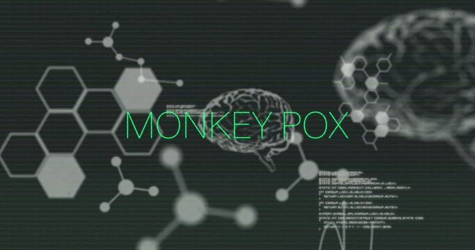 Animation of monkey pox text in green and interference over brains and medical data processing