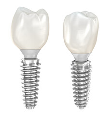Dental implant and ceramic crown. Medically accurate tooth 3D illustration in PNG format. 