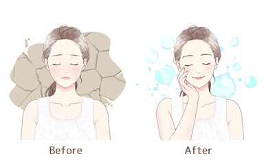 Illustration of a woman suffering from dry skin, before after.