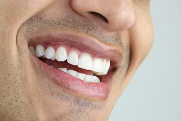young man beautiful smile perfec teeth white 