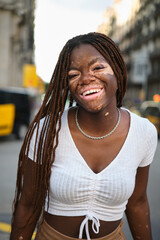 African American woman with vitiligo looking at the camera and smiling while standing outdoors on...