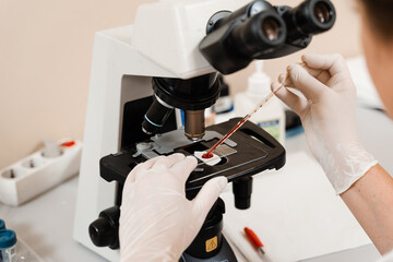 Blood analysis using microscope laboratory close-up. Medical equipment for hematological and...
