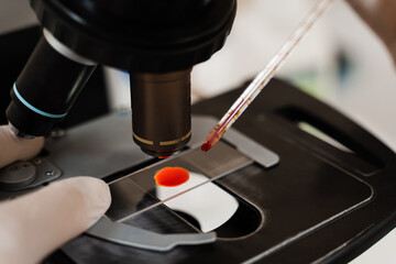 Blood analysis using microscope laboratory close-up. Medical equipment for hematological and biochemical blood tests in medical clinic.