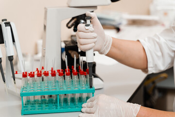 Blood analysis using microscope laboratory close-up. Medical equipment for hematological and...