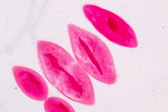 Eggs of helminth and Finding parasites in feces, analyze by microscope in laboratory.
