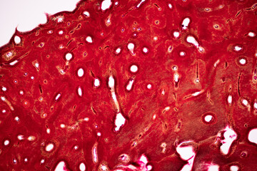 Connective tissue human and Striated muscle human under the microscope in Lab.