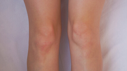 legs and feet