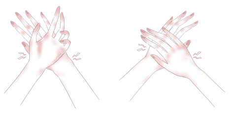 真っ赤に炎症している荒れた手のイラスト2