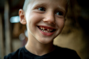 portrait of a 6-year-old boy in close-up, whose baby tooth fell out