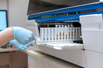 A scientist in a laboratory places test tubes with blood or urine in the container of a thermal...