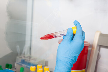 Scientist preparing blood samples for karyotipe and fluorescence in situ hybridization in the ...