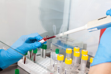 Scientist preparing blood samples for karyotipe and fluorescence in situ hybridization in the ...