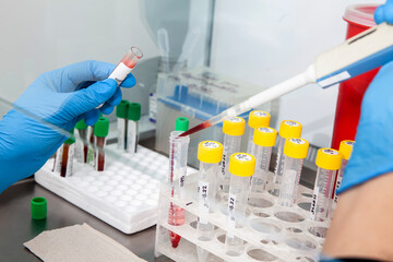 Scientist preparing blood samples for karyotipe and fluorescence in situ hybridization in the ...