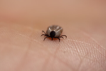 Tick filled with blood sitting on human hand skin. Ixodes ricinus or scapularis. Close-up of dangerous parasitic mite in dynamic motion. Diseases transmission as encephalitis. Macro photography