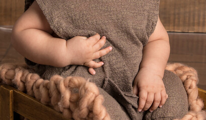 Polydactyly baby hand genetic condition