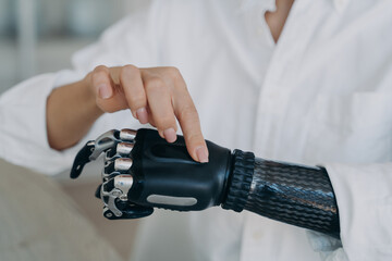 Woman with disability turns on high tech prosthetic arm, showing bionic prosthesis, close-up