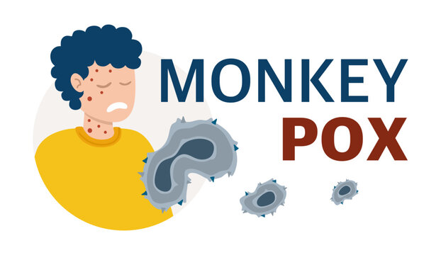 Monkey Pox virus Poster to inform about the pandemic and spread of the disease Images of human virus and monkey Vector Illustration