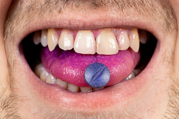 Obraz premium A person shows an indicator pill on his tongue to determine plaque.