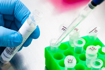 Closeup of a scientist extracting DNA using the spin column-based nucleic acid purification...