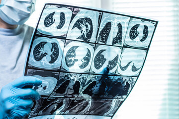 Doctor examining head MRI image in hospital