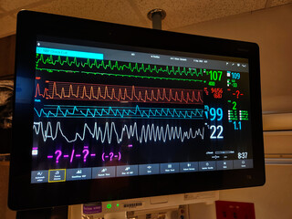 EKG, Pulse, BP, Oxygen saturation and Respiration ICU Monitor Screen