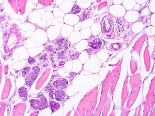 Fototapeta na wymiar Histology of human tissue, show epithelial tissue and connective tissue with microscope view from laboratory (not Illustration Designation)