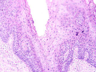 Histology of human tissue, show  epithelial tissue and connective tissue with microscope view  from laboratory (not Illustration Designation)