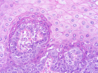 Histology of human tissue, show  epithelial tissue and connective tissue with microscope view  from laboratory (not Illustration Designation)