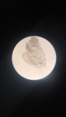 crustacean under a microscope
